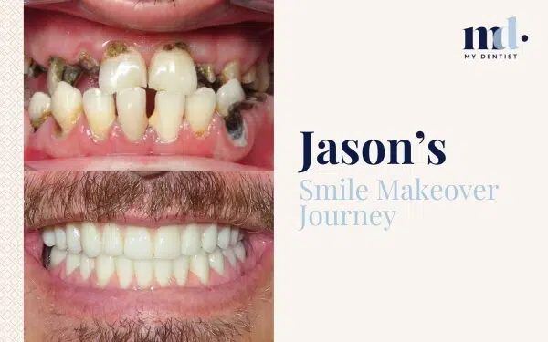 Patient Journeys