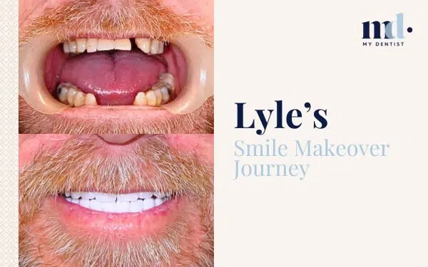 Patient Journeys