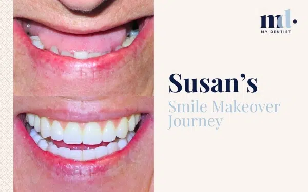 Patient Journeys