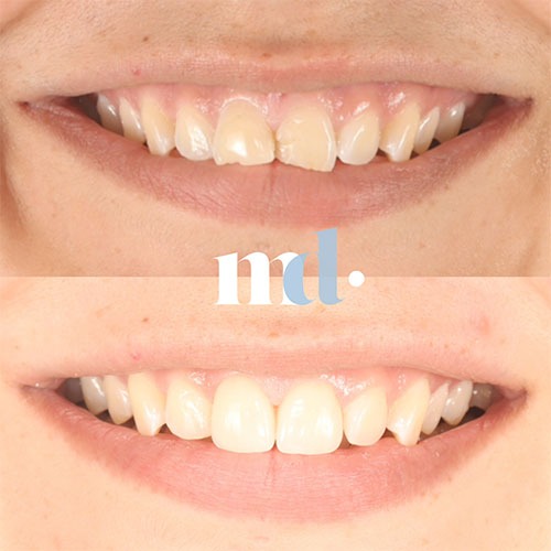 Smile Gallery