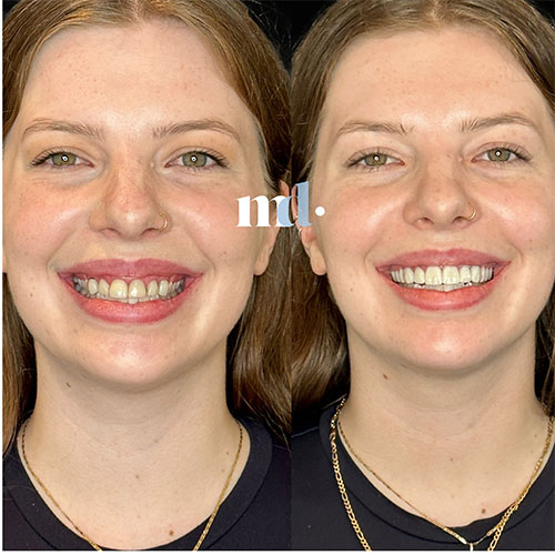 Smile Gallery