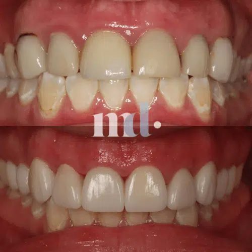 Smile Gallery