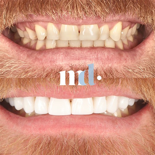 Smile Gallery