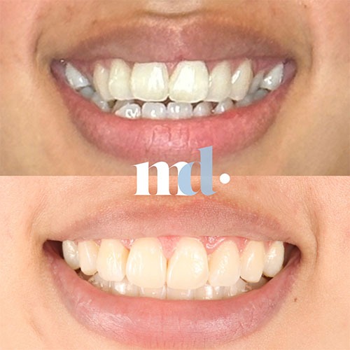 Smile Gallery