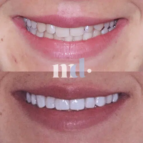 Smile Gallery
