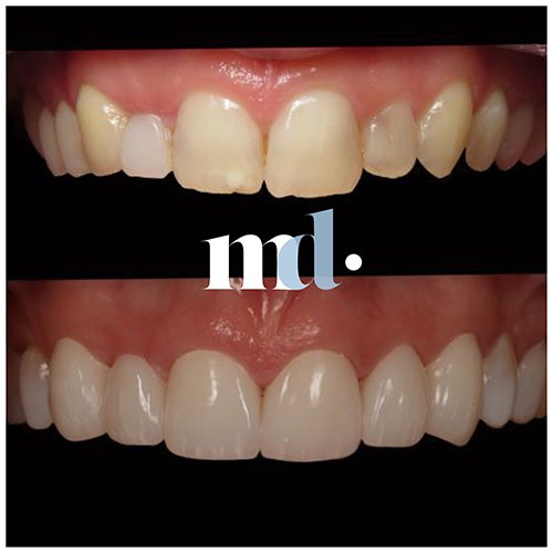 Smile Gallery