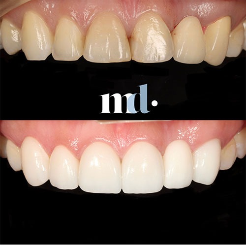 Smile Gallery