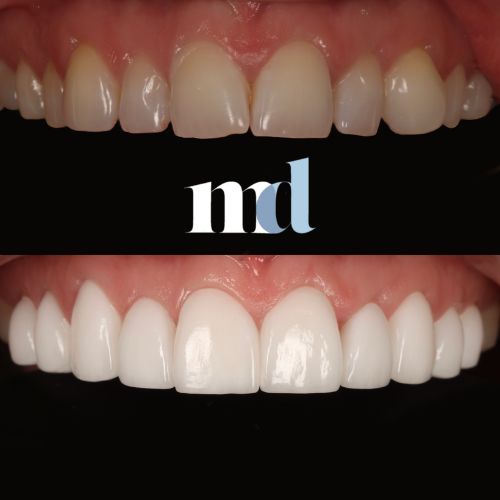 Smile Gallery