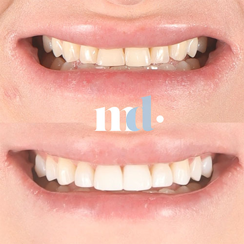 Smile Gallery