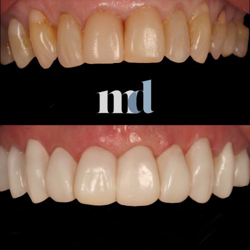 Smile Gallery