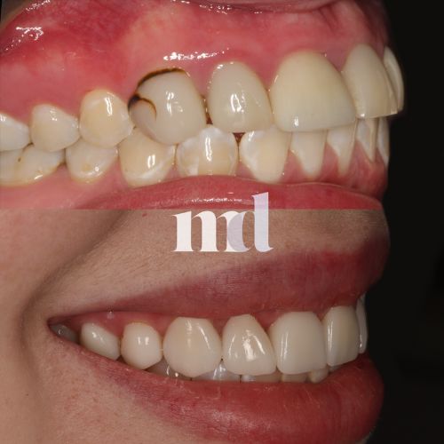 Smile Gallery