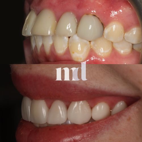Smile Gallery