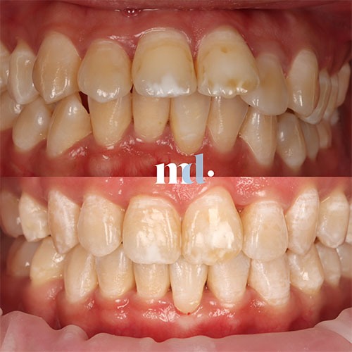 Smile Gallery