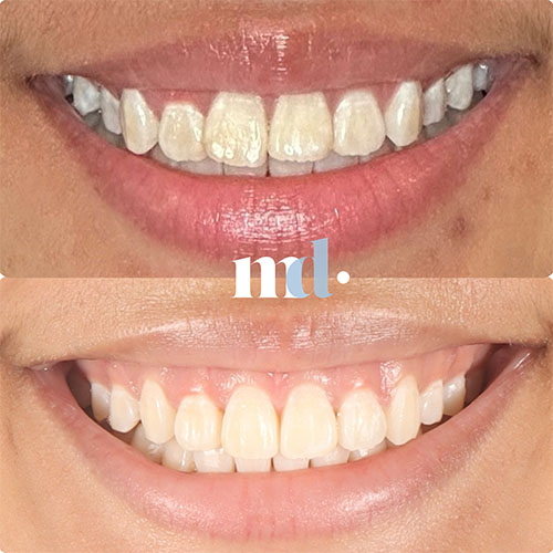 Smile Gallery