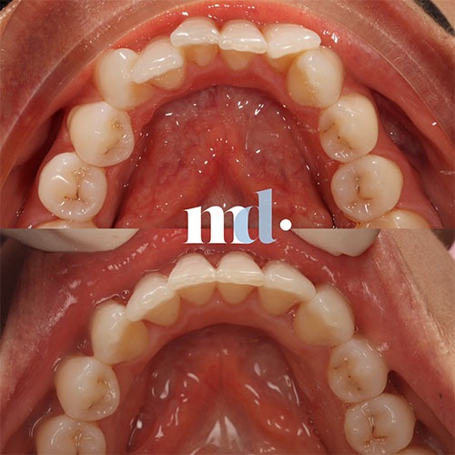 Smile Gallery