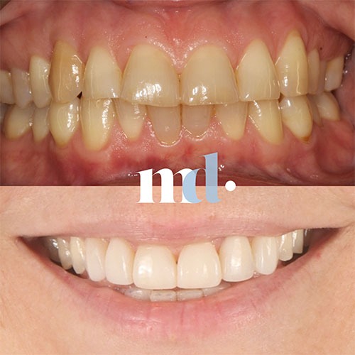 Smile Gallery