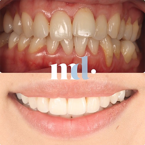Smile Gallery