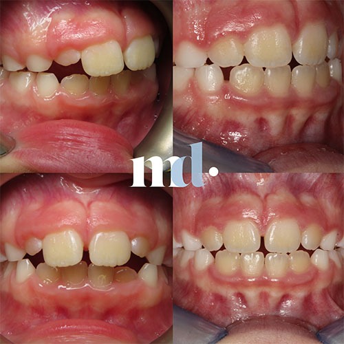 Smile Gallery