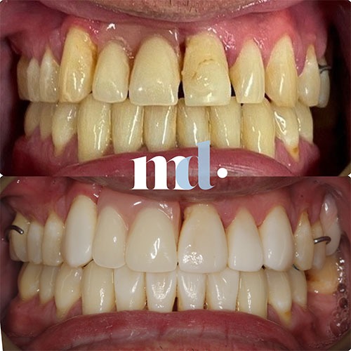 Smile Gallery