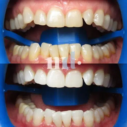 Smile Gallery