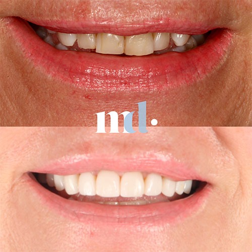 Smile Gallery