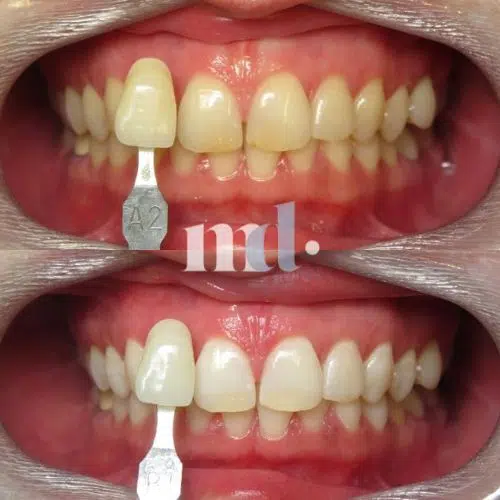 Smile Gallery