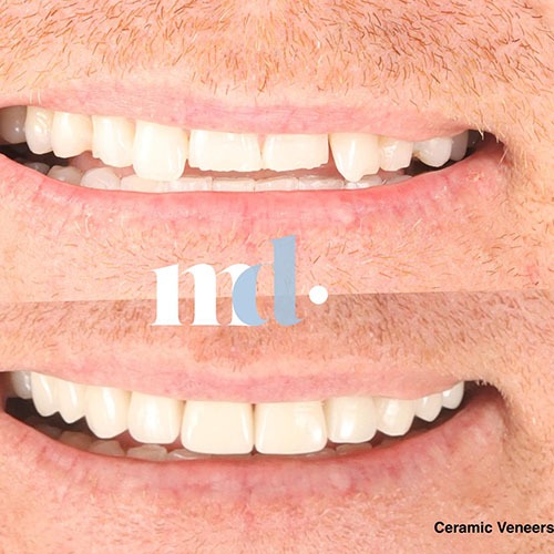 Smile Gallery