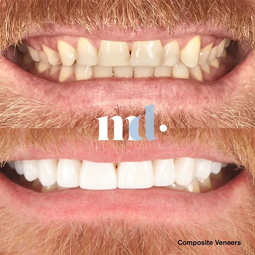 Smile Gallery
