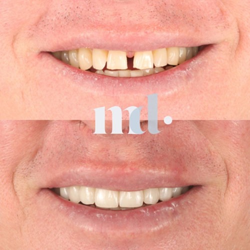 Smile Gallery