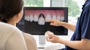 Smile design consultation for a missing front tooth replacement at My Dentist Alderley.