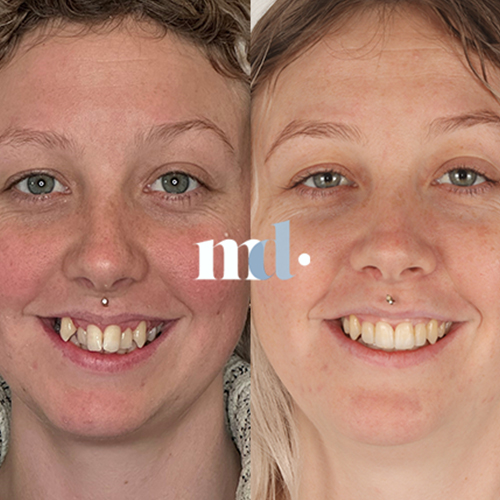 Smile Gallery