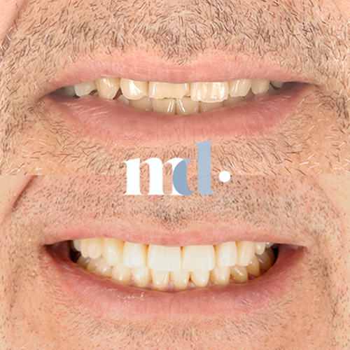Smile Gallery